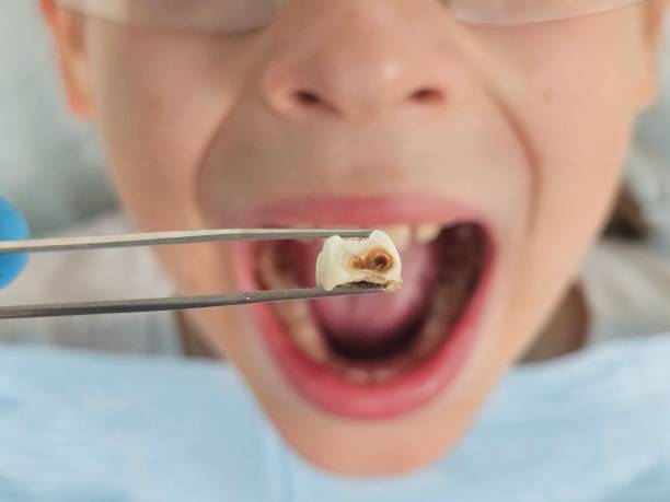Best Cosmetic Emergency Dentistry in St Augusta, MN