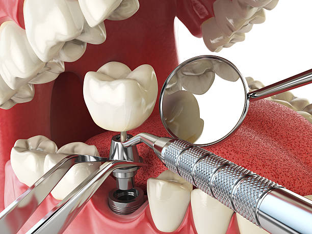 Best Emergency Gum Treatment in St Augusta, MN
