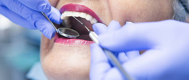 Best Emergency Dental Care for Broken or Chipped Teeth in St Augusta, MN